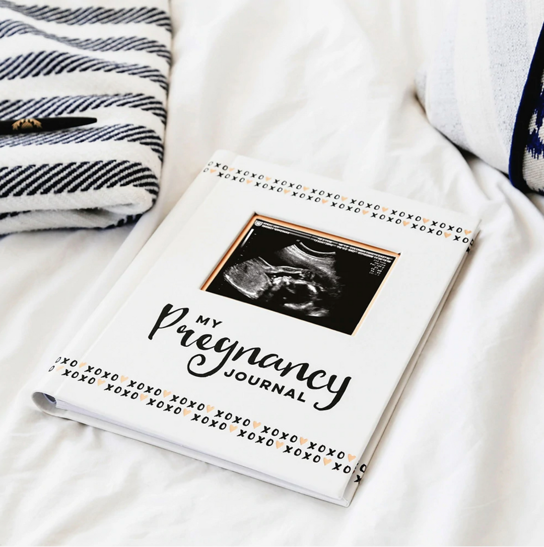 Pearhead Pregnancy Journal - Black, White & Gold